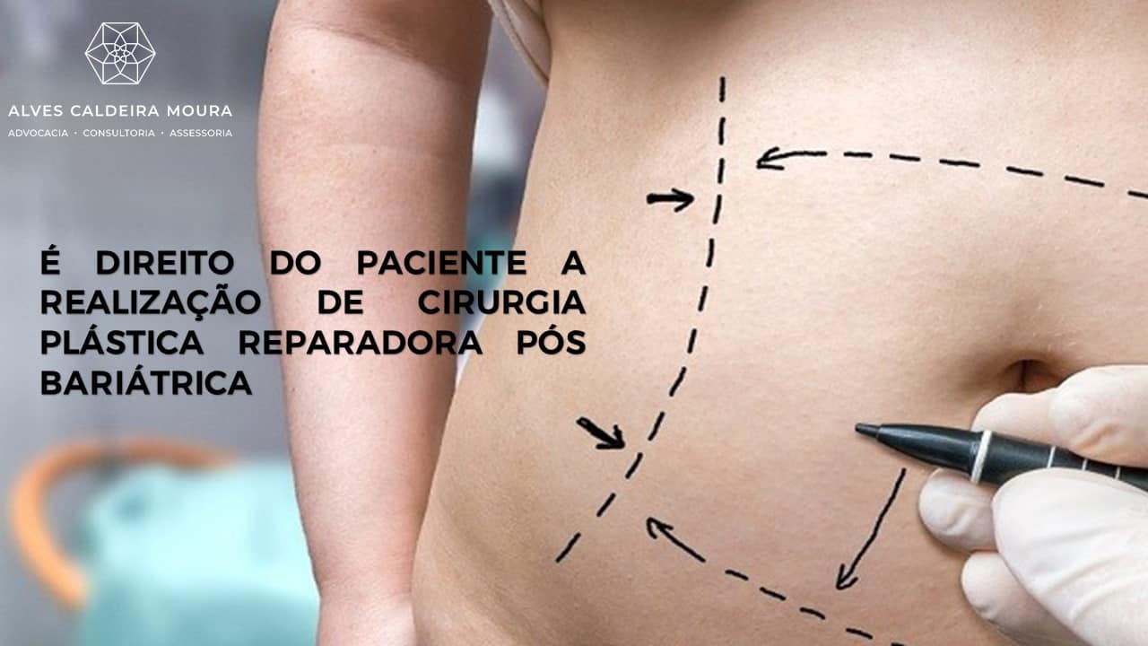 O Que É Cirurgia Plastica Reparadora Exemplos